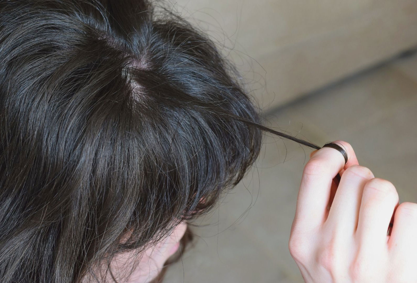 Trichotillomania: Signs, Causes and Treatment - Remedy Psychiatry, Inc